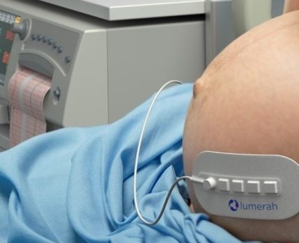 Lumerah Fetal Monitoring
